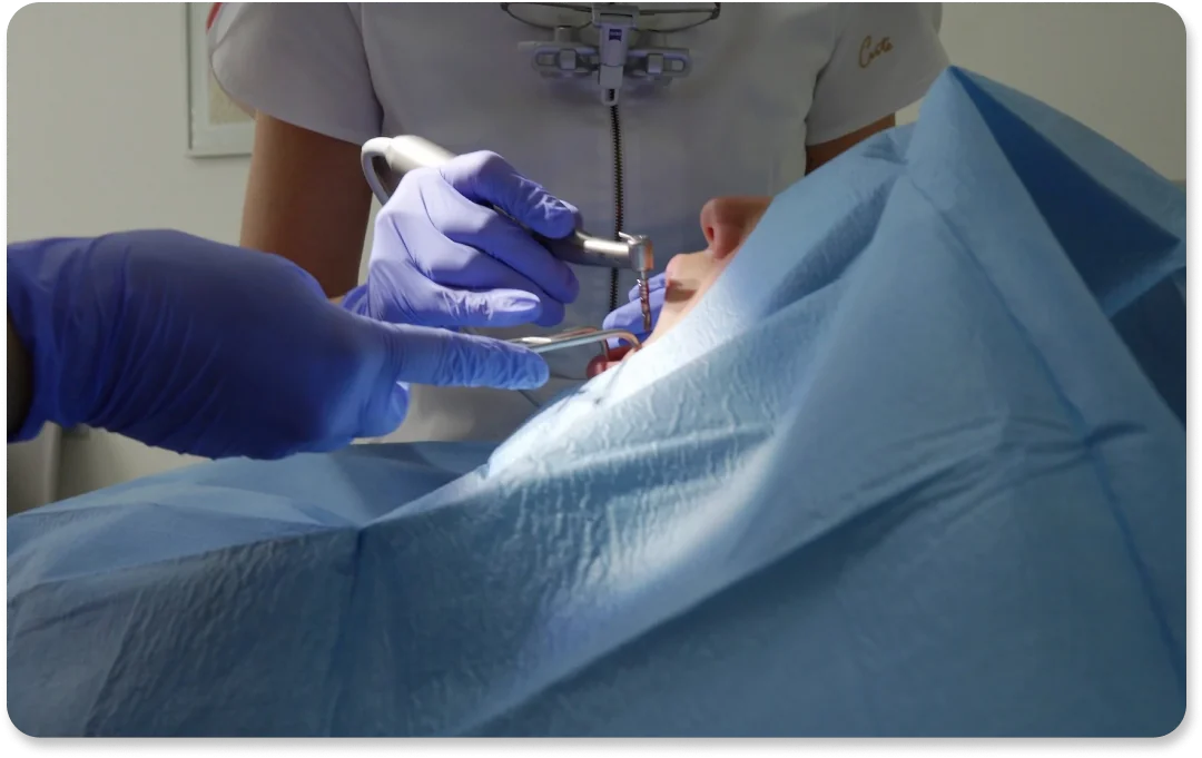 Implantologija - Dental Centar Dubrava Implantologija