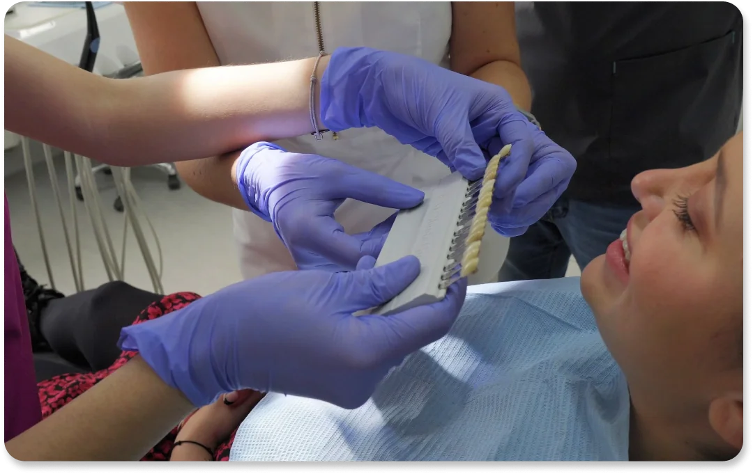 Izbjeljivanje - Dental Centar Dubrava Izbjeljivanje