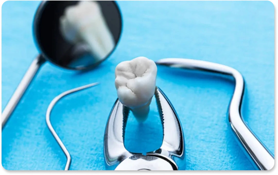 Oralna kirurgija - Dental Centar Dubrava Oralna kirurgija